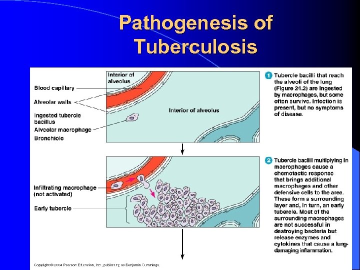 Pathogenesis of Tuberculosis 