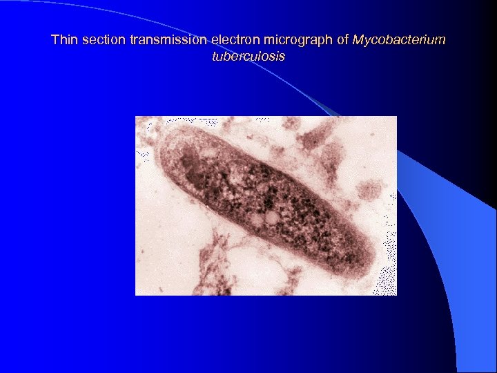 Thin section transmission electron micrograph of Mycobacterium tuberculosis 