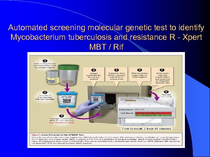 Automated screening molecular genetic test to identify Mycobacterium tuberculosis and resistance R - Xpert