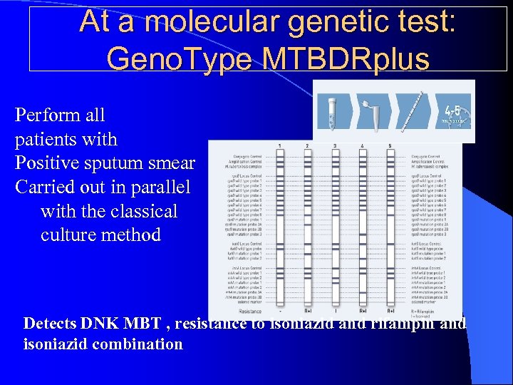 At a molecular genetic test: Geno. Type MTBDRplus Perform all patients with Positive sputum