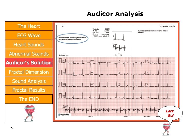 Audicor Analysis The Heart ECG Wave Heart Sounds Abnormal Sounds Audicor’s Solution Fractal Dimension