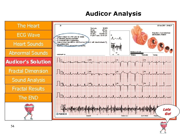 Audicor Analysis The Heart ECG Wave Heart Sounds Abnormal Sounds Audicor’s Solution Fractal Dimension
