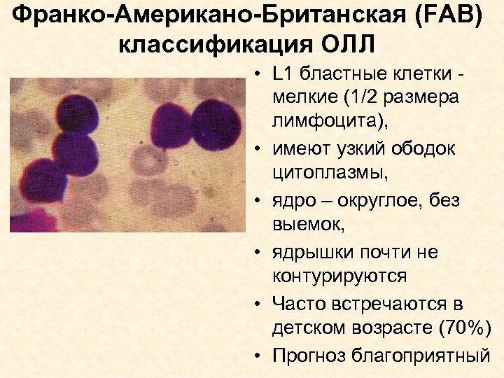 Бластные клетки. Лимфоциты бластные клетки. Бластные клетки в анализе крови что это. Бластные формы лейкоцитов. Морфология бластной клетки.