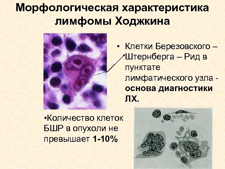 Лимфопролиферативные заболевания презентация