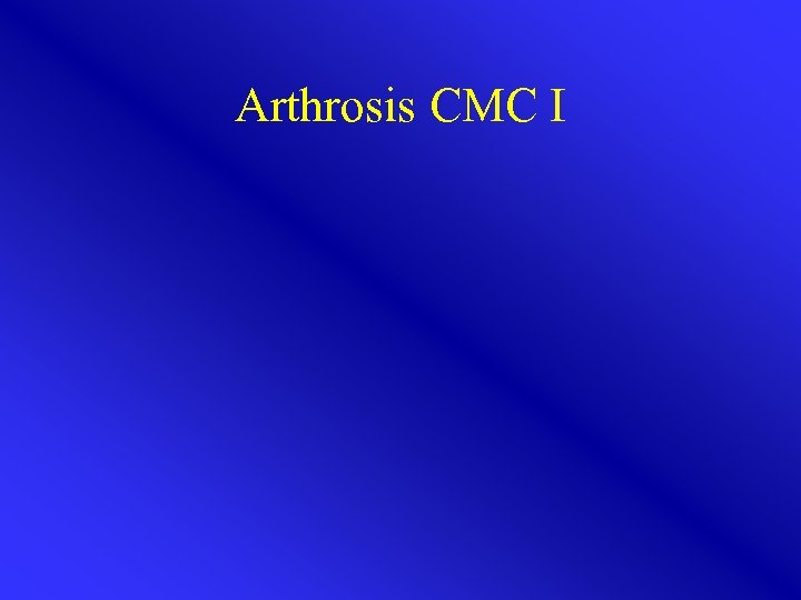 Arthrosis CMC I 