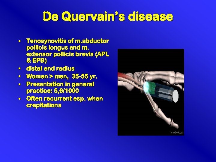 De Quervain’s disease • Tenosynovitis of m. abductor pollicis longus and m. extensor pollicis