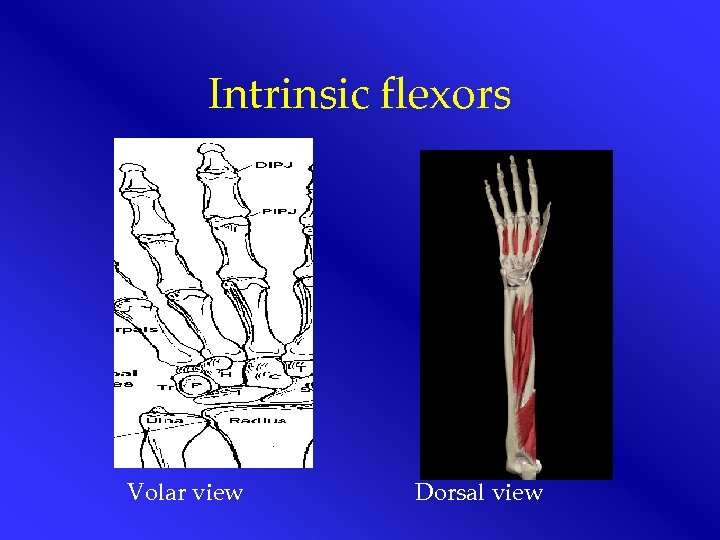 Intrinsic flexors Volar view Dorsal view 