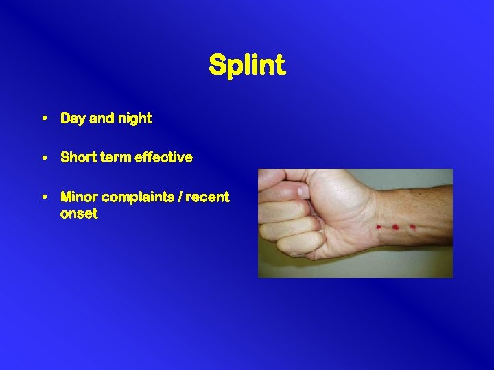 Splint • Day and night • Short term effective • Minor complaints / recent