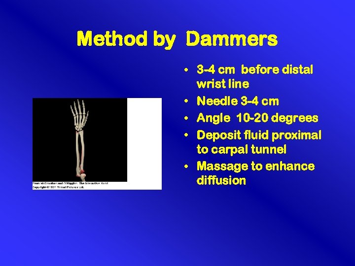 Method by Dammers • 3 -4 cm before distal wrist line • Needle 3