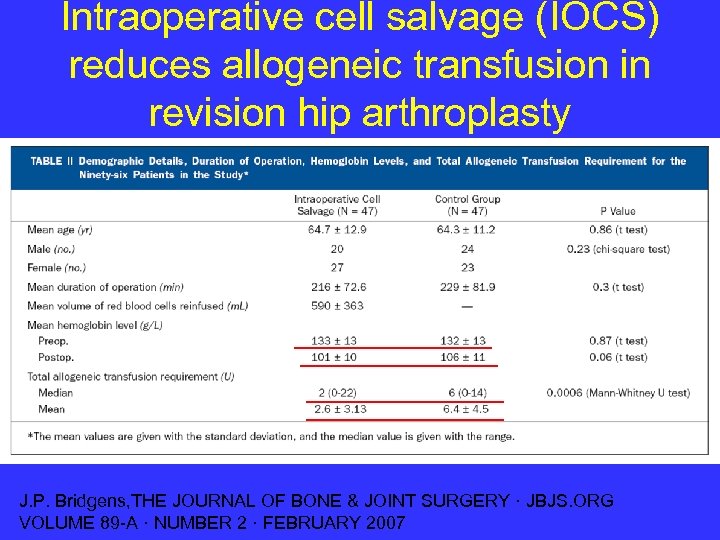 Intraoperative cell salvage (IOCS) reduces allogeneic transfusion in revision hip arthroplasty J. P. Bridgens,