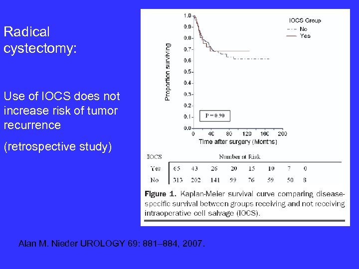 Radical cystectomy: Use of IOCS does not increase risk of tumor recurrence (retrospective study)