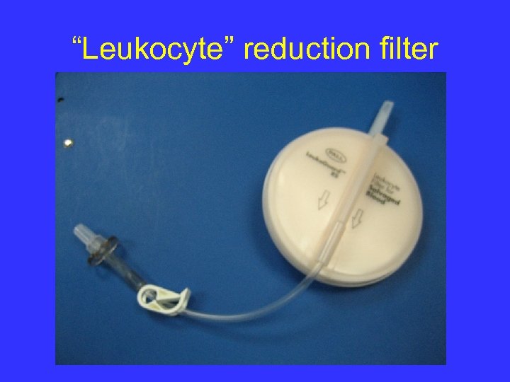 “Leukocyte” reduction filter 