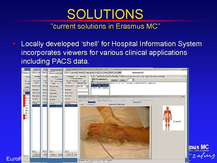 SOLUTIONS ”current solutions in Erasmus MC” • Locally developed ‘shell’ for Hospital Information System