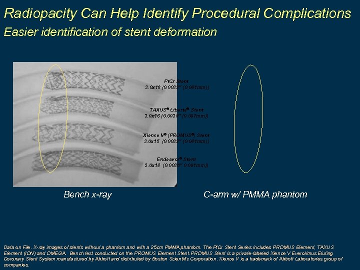 Radiopacity Can Help Identify Procedural Complications Easier identification of stent deformation Pt. Cr Stent