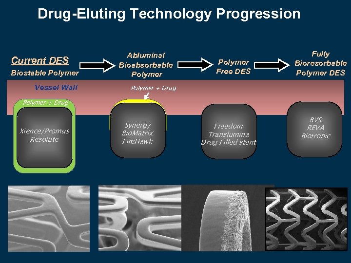 Drug-Eluting Technology Progression Current DES Biostable Polymer Vessel Wall Abluminal Bioabsorbable Polymer Free DES