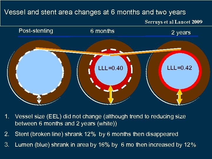 Vessel and stent area changes at 6 months and two years Serruys et al