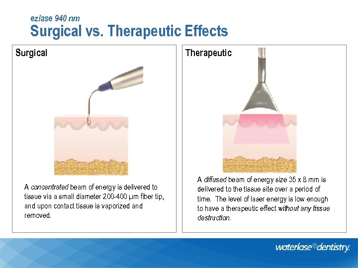 ezlase 940 nm Surgical vs. Therapeutic Effects Surgical A concentrated beam of energy is