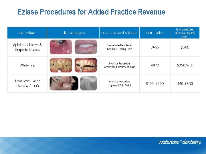 Ezlase Procedures for Added Practice Revenue 