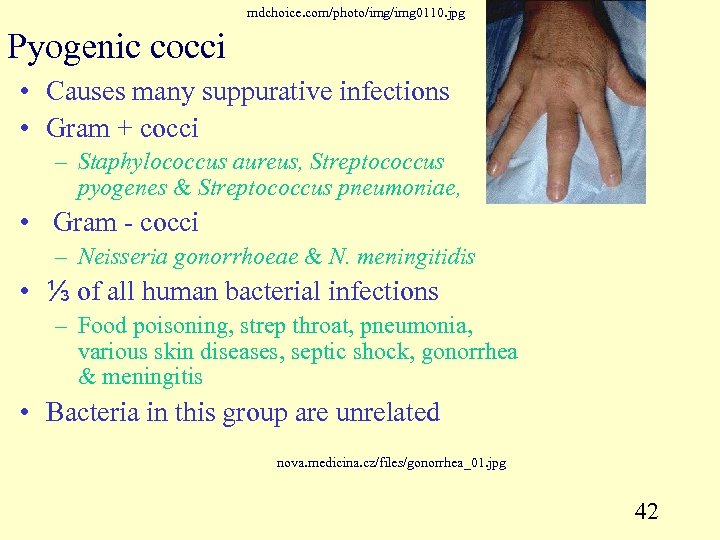 mdchoice. com/photo/img 0110. jpg Pyogenic cocci • Causes many suppurative infections • Gram +
