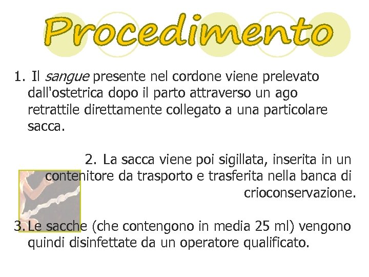 1. Il sangue presente nel cordone viene prelevato dall'ostetrica dopo il parto attraverso un