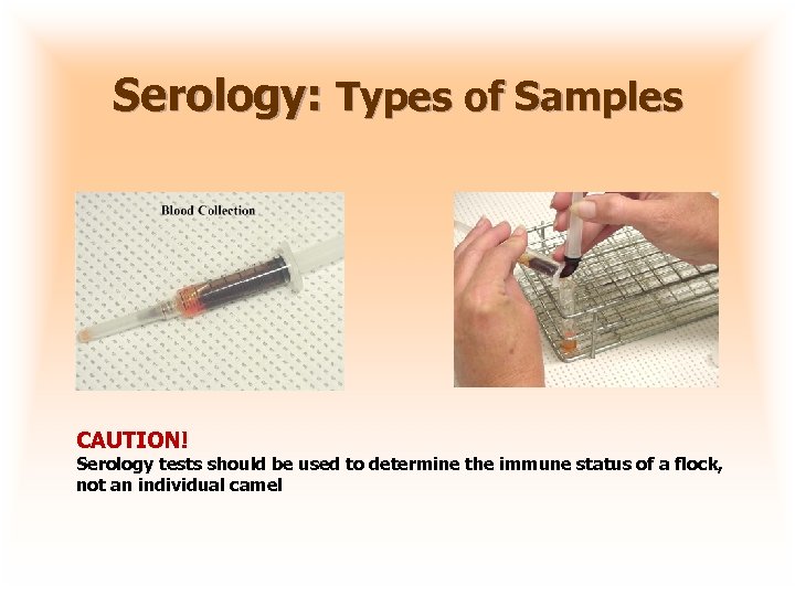 Serology: Types of Samples CAUTION! Serology tests should be used to determine the immune