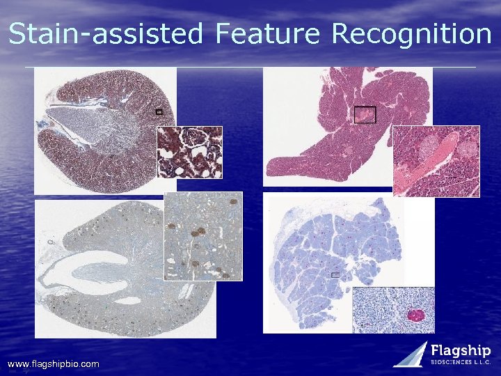 Stain-assisted Feature Recognition www. flagshipbio. com 