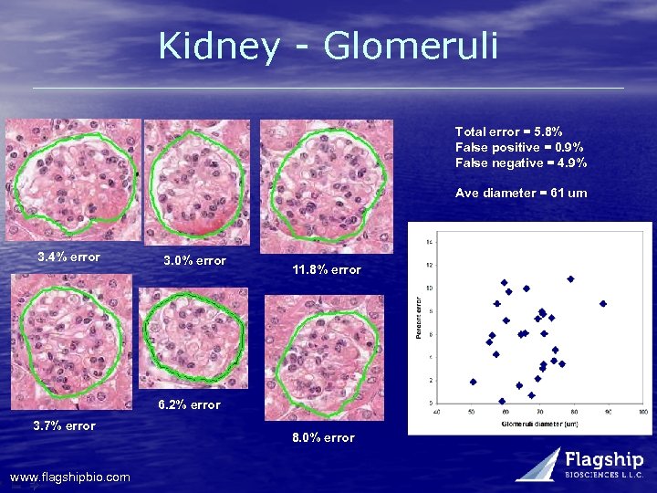 Kidney - Glomeruli Total error = 5. 8% False positive = 0. 9% False