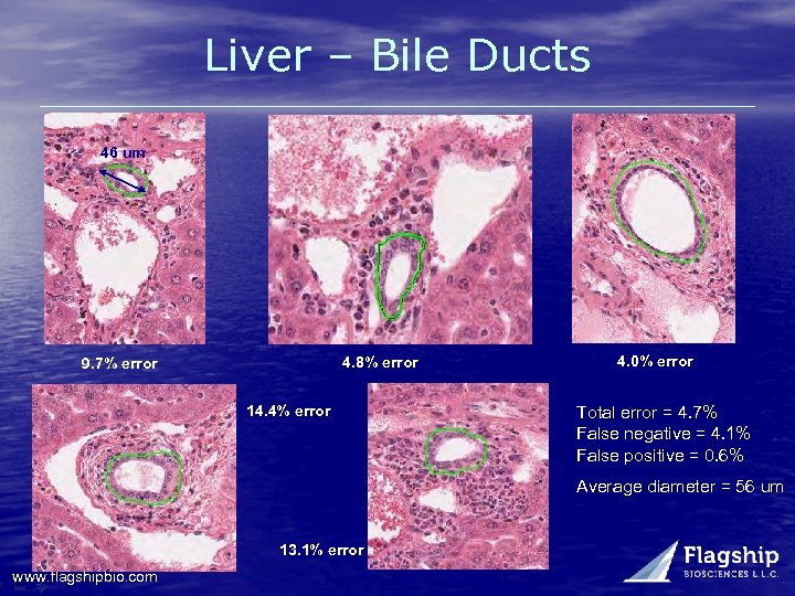 Liver – Bile Ducts 46 um 4. 8% error 9. 7% error 14. 4%