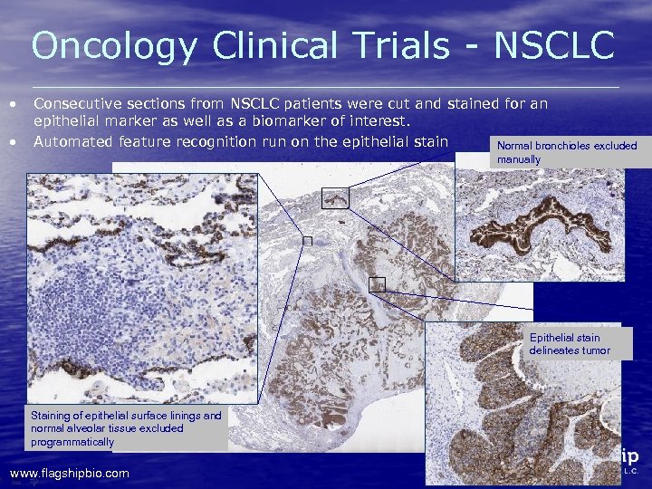 Oncology Clinical Trials - NSCLC • • Consecutive sections from NSCLC patients were cut