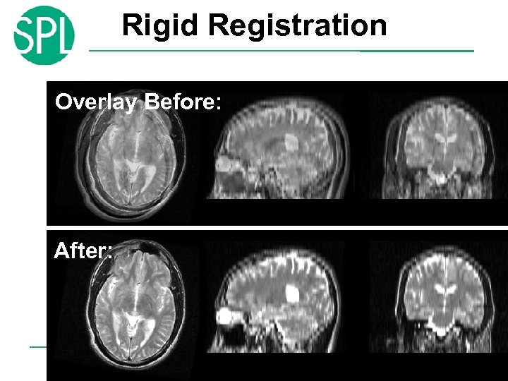 Rigid Registration Overlay Before: After: © 2007 Surgical Planning Laboratory, ARR Slide 12 