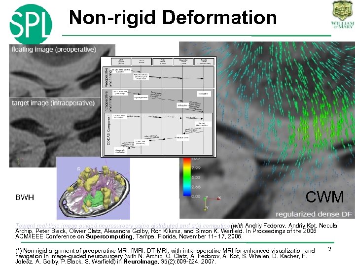 Non-rigid Deformation BWH CWM Toward real-time image guided neurosurgery using distributed and grid computing