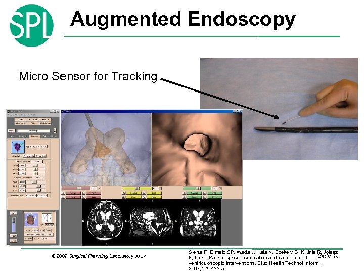Augmented Endoscopy Micro Sensor for Tracking © 2007 Surgical Planning Laboratory, ARR Sierra R,