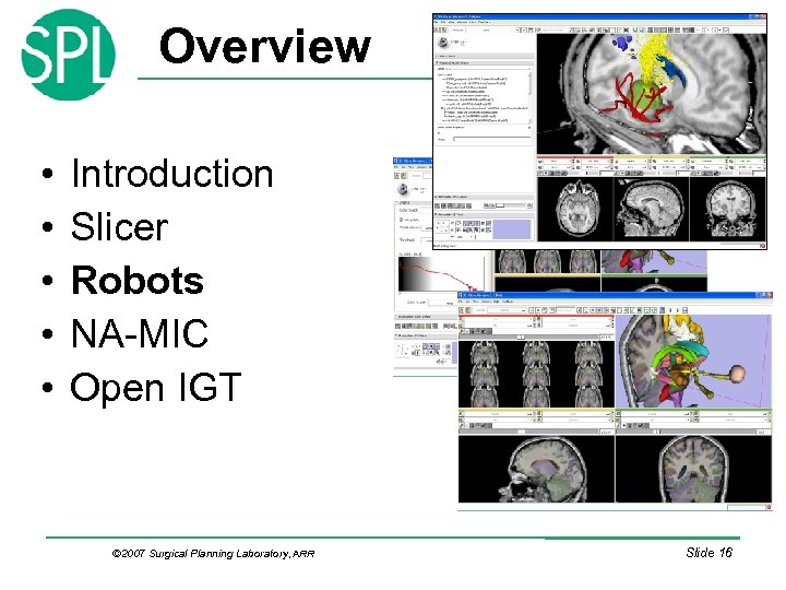 Overview • • • Introduction Slicer Robots NA-MIC Open IGT © 2007 Surgical Planning