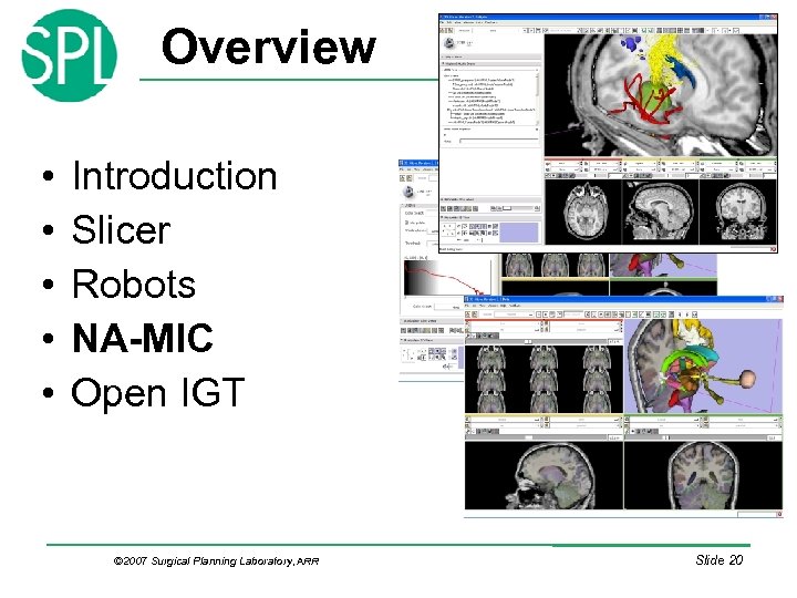 Overview • • • Introduction Slicer Robots NA-MIC Open IGT © 2007 Surgical Planning