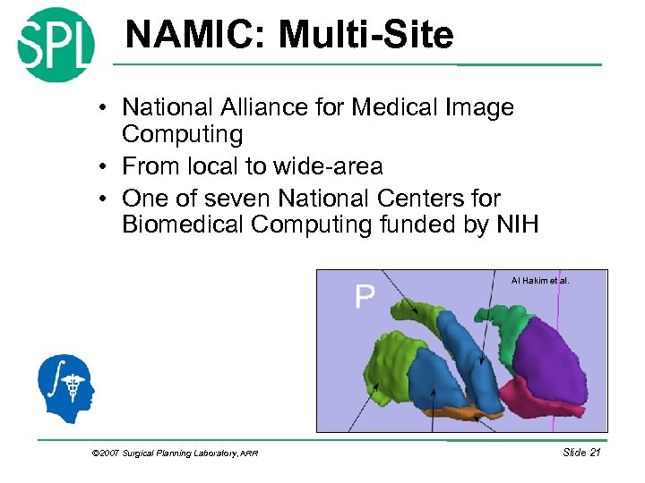 NAMIC: Multi-Site • National Alliance for Medical Image Computing • From local to wide-area