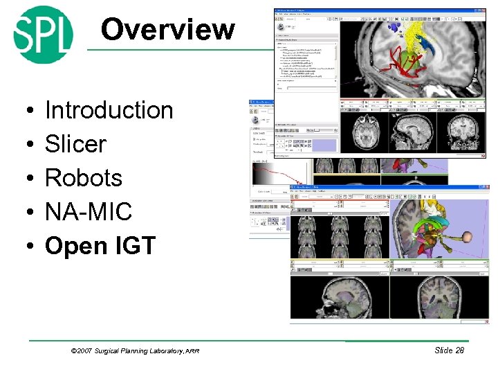 Overview • • • Introduction Slicer Robots NA-MIC Open IGT © 2007 Surgical Planning
