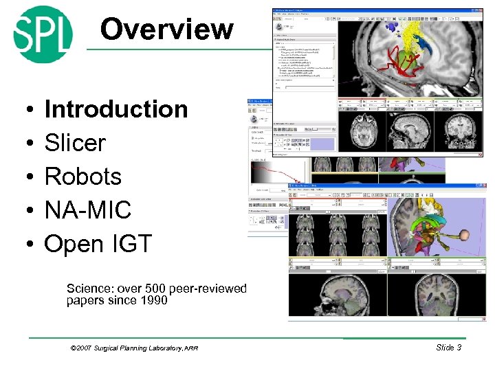 Overview • • • Introduction Slicer Robots NA-MIC Open IGT Science: over 500 peer-reviewed