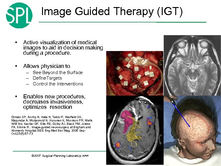 Image Guided Therapy (IGT) • Active visualization of medical images to aid in decision