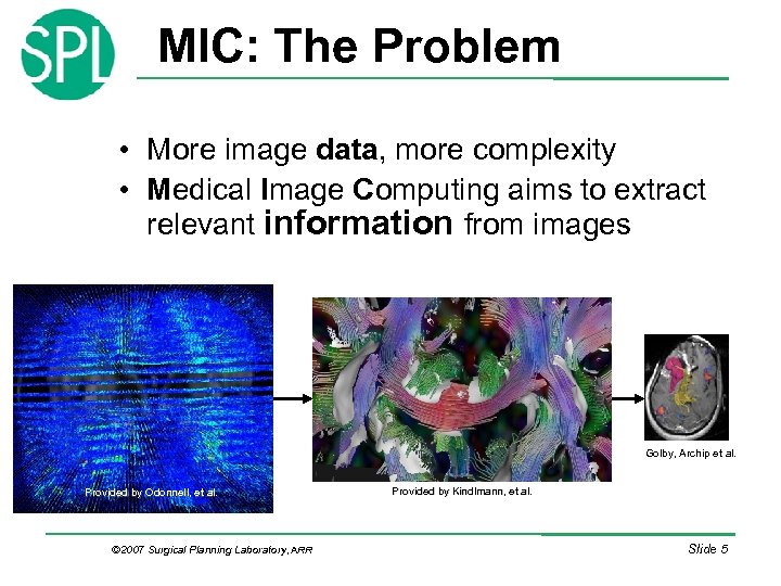 MIC: The Problem • More image data, more complexity • Medical Image Computing aims