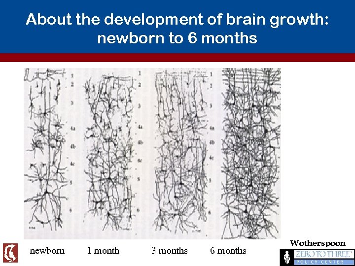 About the development of brain growth: newborn to 6 months newborn 1 month 3
