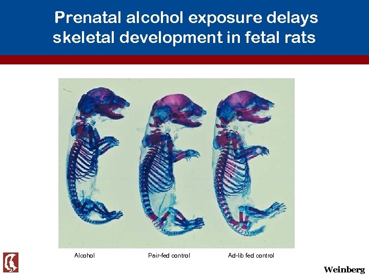 Prenatal alcohol exposure delays skeletal development in fetal rats Alcohol Pair-fed control Ad-lib fed