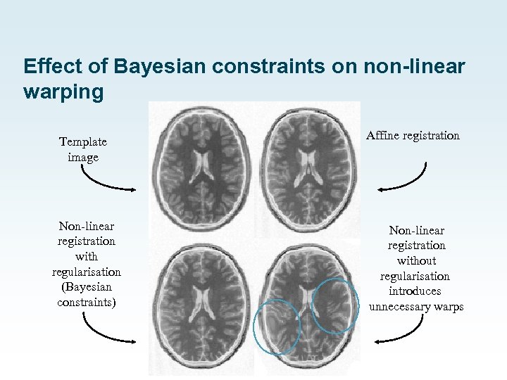 Effect of Bayesian constraints on non-linear warping Template image Affine registration Non-linear registration with