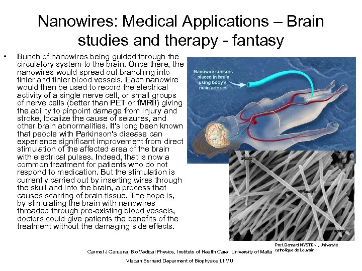 Nanowires: Medical Applications – Brain studies and therapy - fantasy • Bunch of nanowires