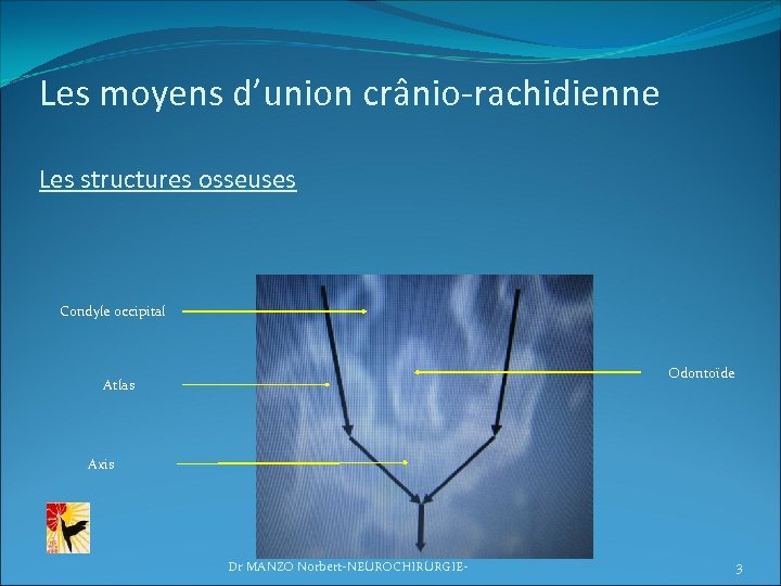 Les moyens d’union crânio-rachidienne Les structures osseuses Condyle occipital Odontoïde Atlas Axis Dr MANZO