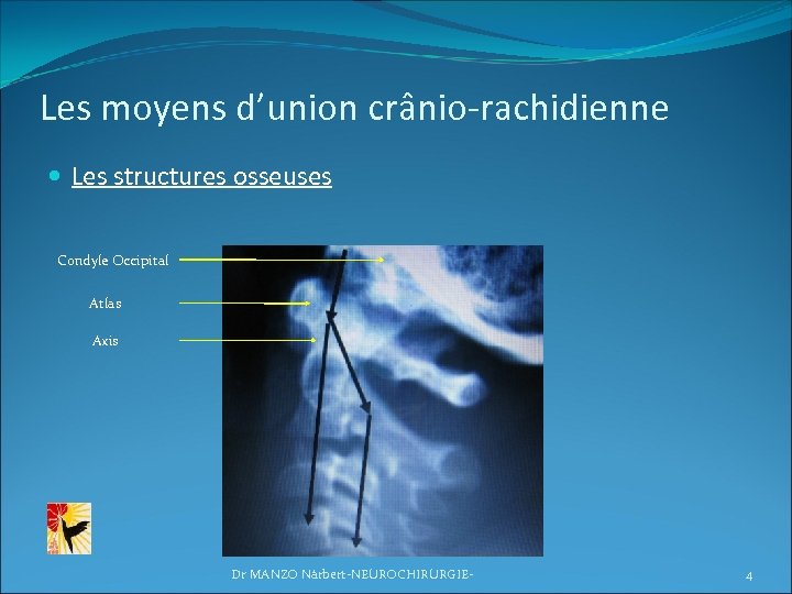 Les moyens d’union crânio-rachidienne Les structures osseuses Condyle Occipital Atlas Axis Dr MANZO Nàrbert-NEUROCHIRURGIE-