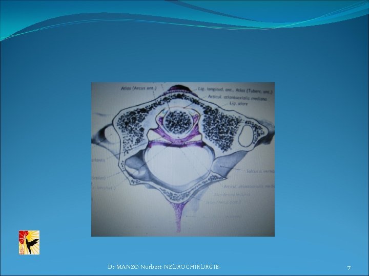 Dr MANZO Norbert-NEUROCHIRURGIE- 7 