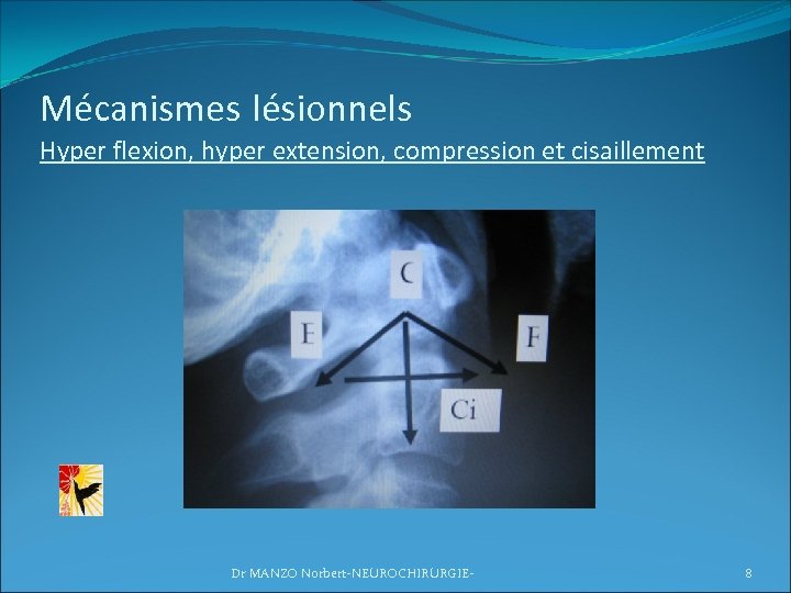 Mécanismes lésionnels Hyper flexion, hyper extension, compression et cisaillement Dr MANZO Norbert-NEUROCHIRURGIE- 8 