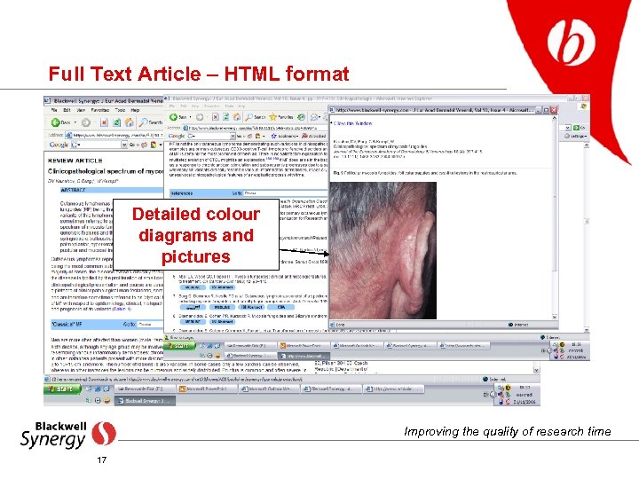 Full Text Article – HTML format Detailed colour diagrams and pictures Improving the quality