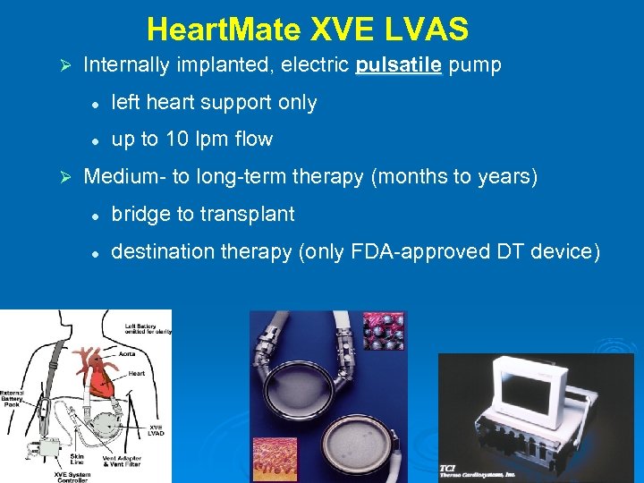 Heart. Mate XVE LVAS Ø Internally implanted, electric pulsatile pump l l Ø left