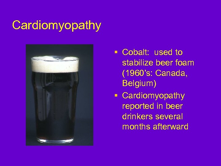 Cardiomyopathy § Cobalt: used to stabilize beer foam (1960’s: Canada, Belgium) § Cardiomyopathy reported